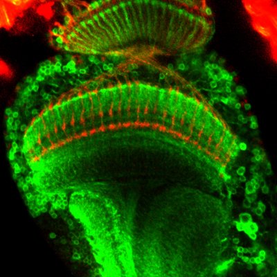 A strain of flies was generated with fluorescent brain cells